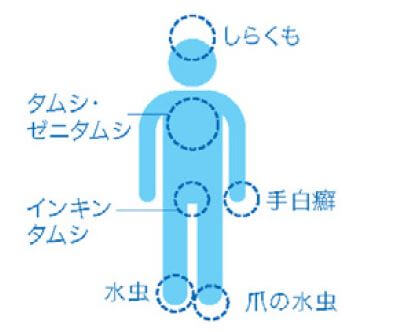 市販の水虫薬 の選び方 水虫の症状と予防法 くすりんの豆知識 V ドラッグ